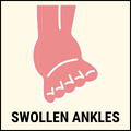 Swollen ankles and Feet